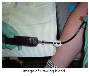 Image of Drawing blood